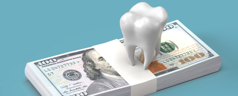 dental crowns expensive